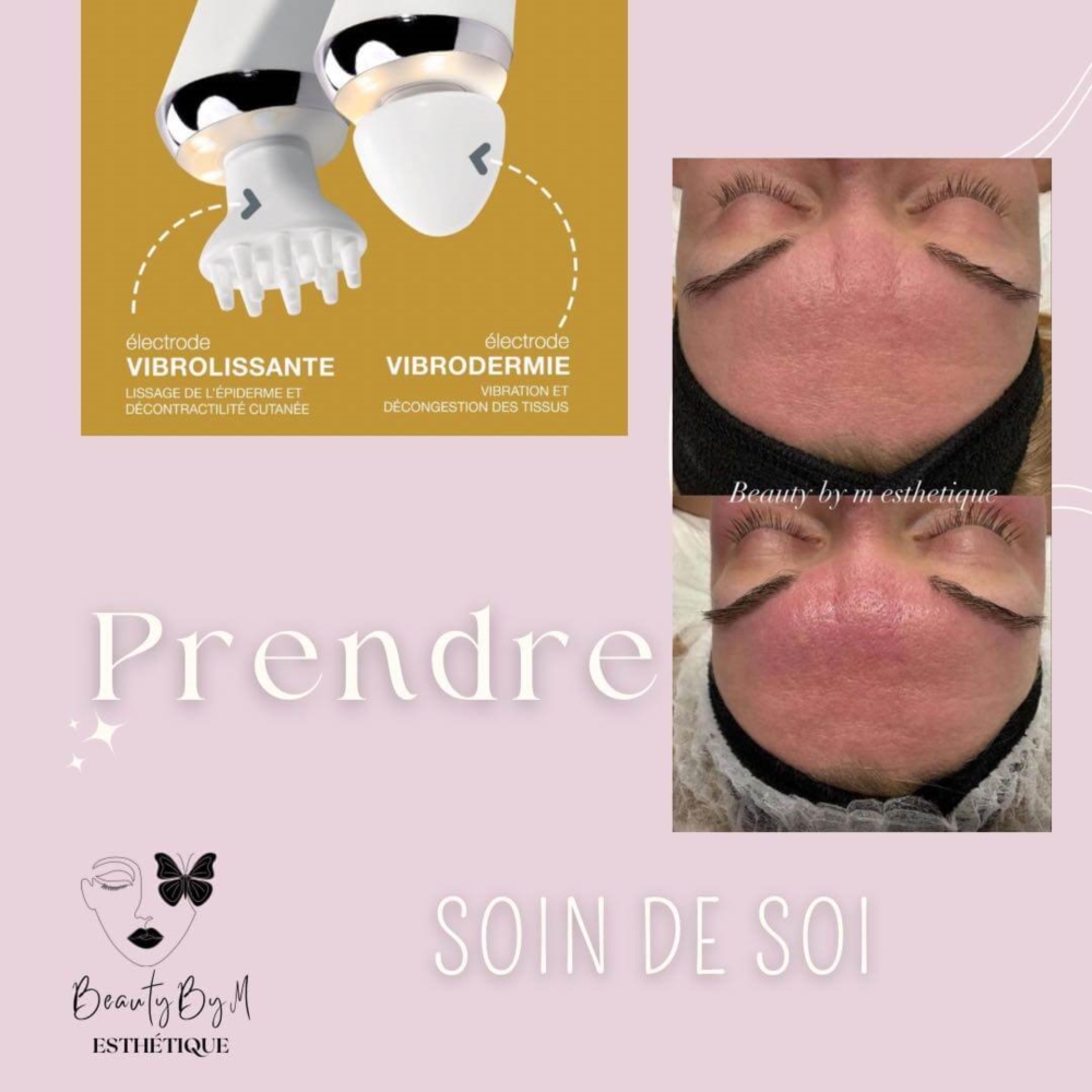 Découvrez la vibrodermie chez Beauty by M Esthétique