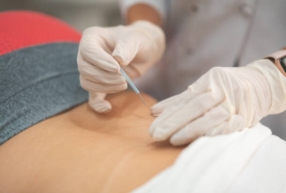 Acupuncture & ostéopathie