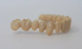 PROTHÈSES DENTAIRES