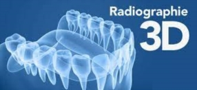 Radiographie 3D