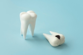 Traitement de caries