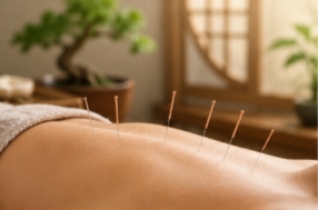 Acupuncture traditionnelle chinoise