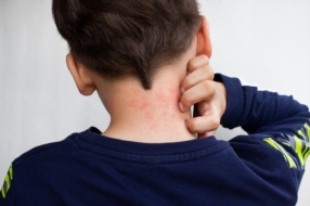Allergies cutanées