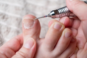 Pédicure Médicale – Pour des pieds en pleine santé 