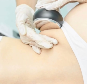 Cavitation