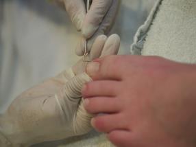 Medezinesch Pediküre