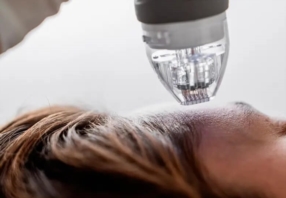 Découvrez le Micro Needling & Radiofréquence fractionnée