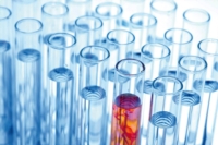 Artikel vu Laboratoire d'Analyses Médicales Ketterthill