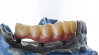 Article de Optident Sàrl