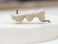 Article fromOptident Sàrl